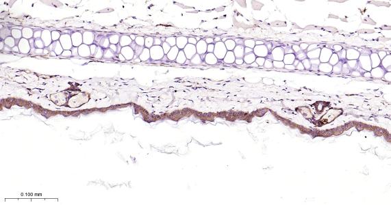 表皮生长因子受体重组兔单抗