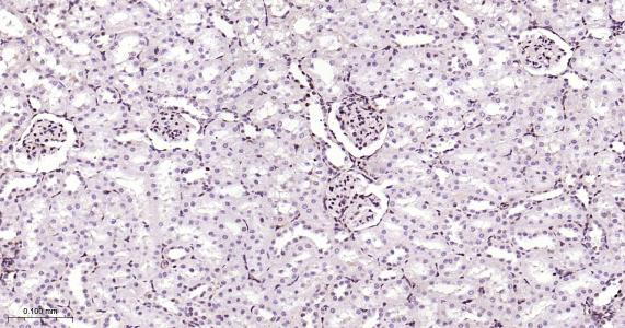 P27/周期素依赖激酶抑制剂重组兔单抗