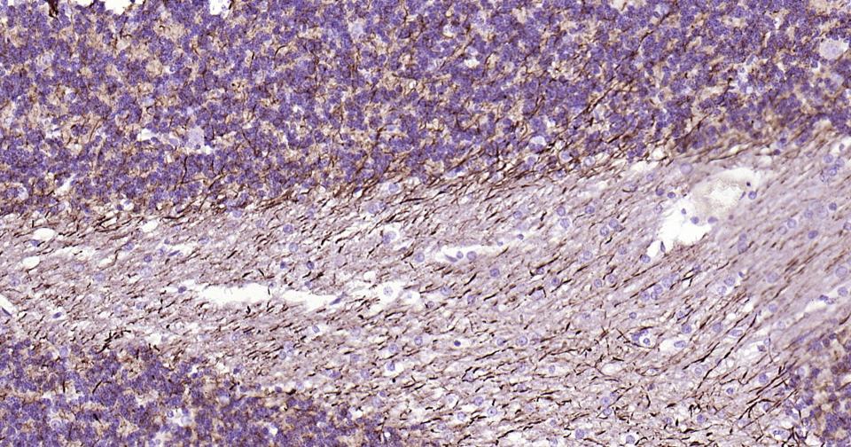 α-中连蛋白重组兔单抗