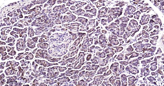 糖原合酶激酶-3β重组兔单抗