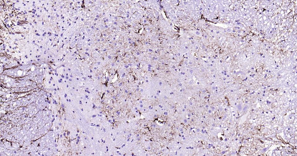 胶质纤维酸性蛋白重组兔单抗