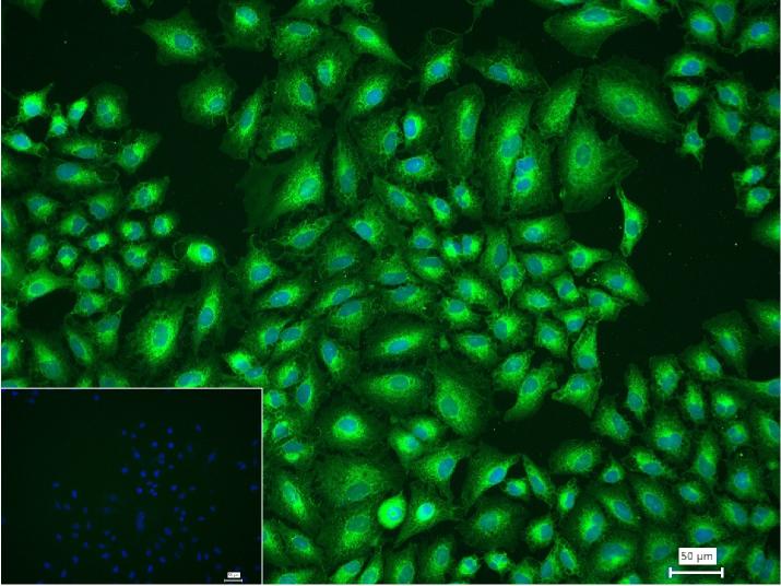 髓样分化蛋白重组兔单抗