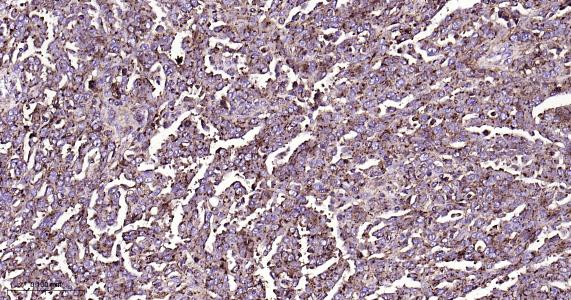 突触素样蛋白1重组兔单抗