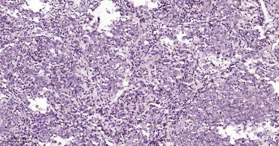 P27/周期素依赖激酶抑制剂重组兔单抗