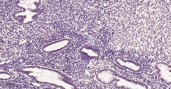 磷酸化雌激素受体ER alpha 重组兔单抗