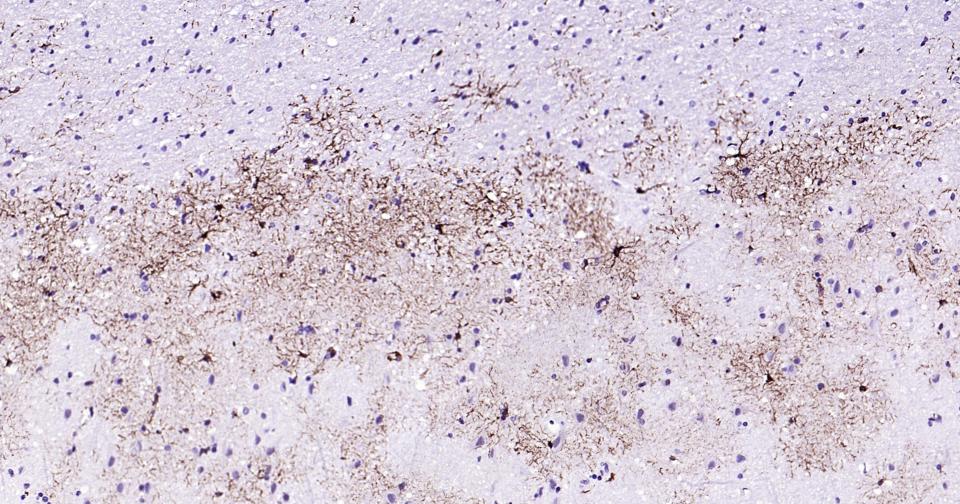 胶质纤维酸性蛋白重组兔单抗