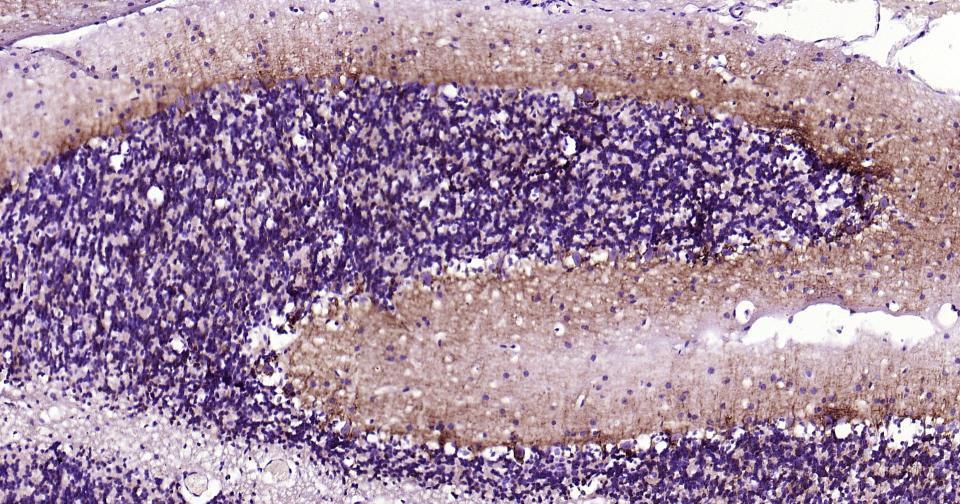 α-中连蛋白重组兔单抗