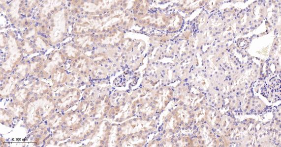 酰基辅酶A合成酶4重组兔单抗