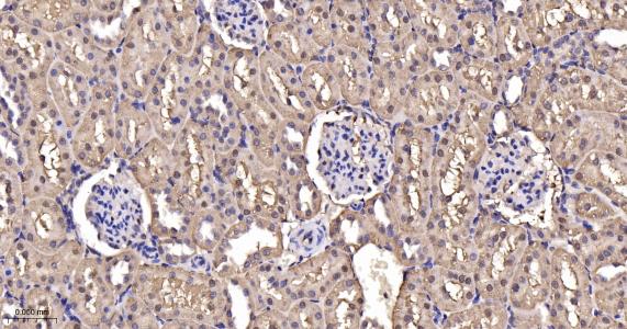 超氧化物歧化酶1重组兔单抗