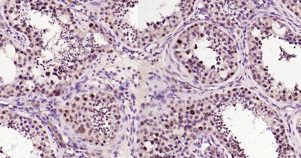 BRD2蛋白重组兔单抗