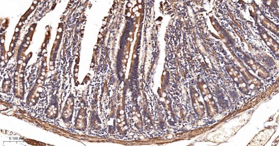 酰基辅酶A合成酶4重组兔单抗