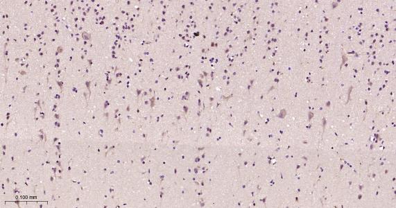 神经生长因子β重组兔单抗