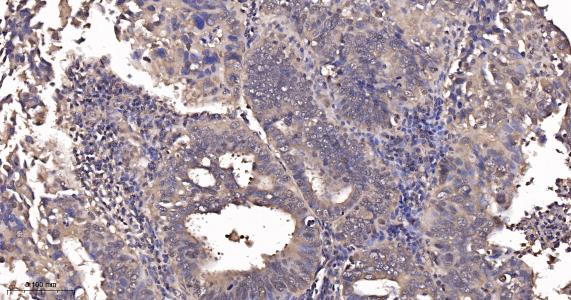 超氧化物歧化酶1重组兔单抗