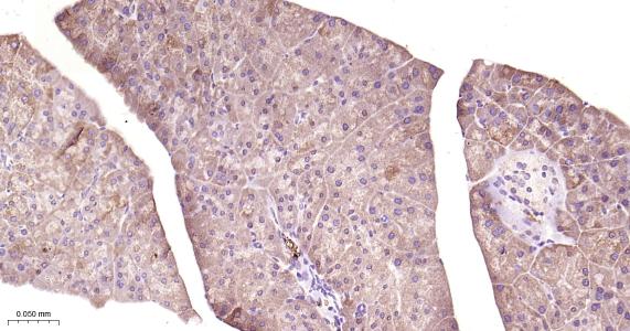糖原合酶激酶-3β重组兔单抗