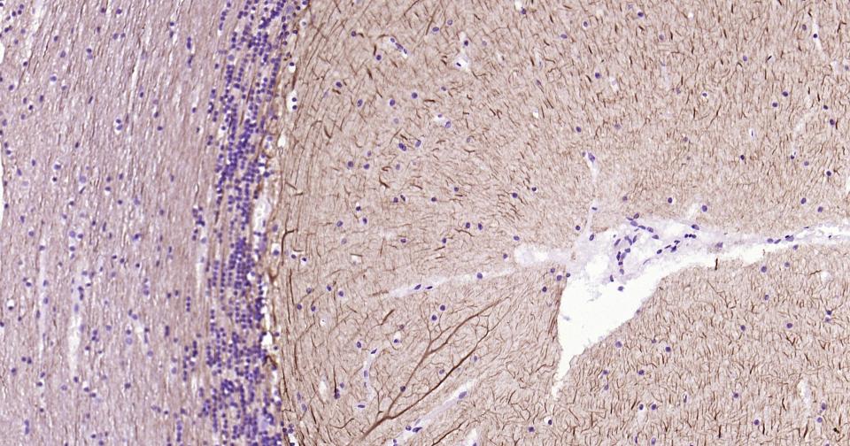 α-中连蛋白重组兔单抗
