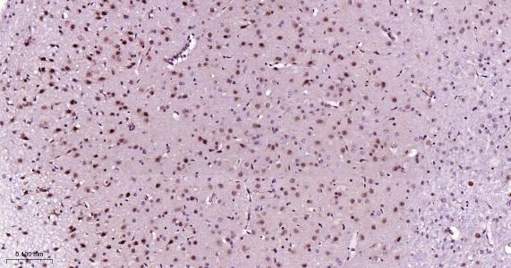 P27/周期素依赖激酶抑制剂重组兔单抗