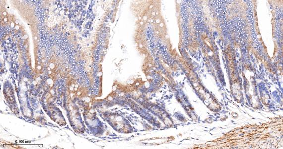 酰基辅酶A合成酶4重组兔单抗