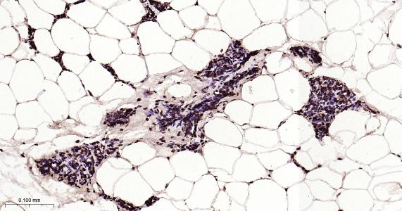 磷酸化雌激素受体ER alpha 重组兔单抗