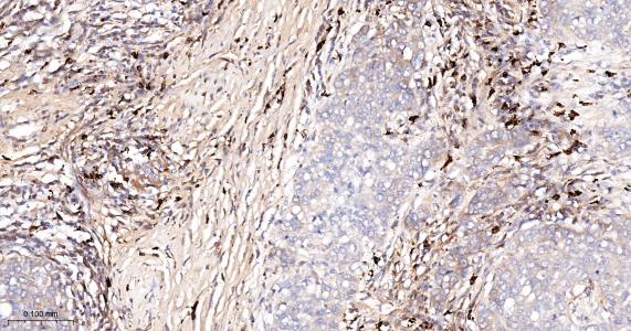 促凋亡BNIP3L蛋白重组兔单抗