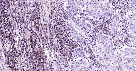 P27/周期素依赖激酶抑制剂重组兔单抗