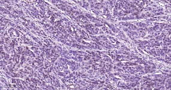 P27/周期素依赖激酶抑制剂重组兔单抗
