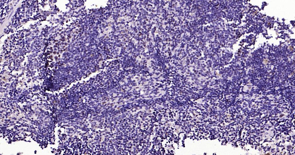 抑癌蛋白EZH2重组兔单抗