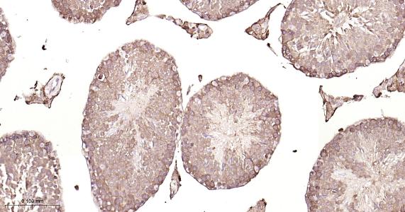 铁蛋白重组兔单抗