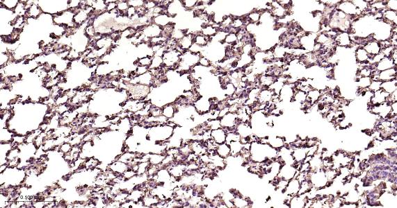 铁蛋白重组兔单抗