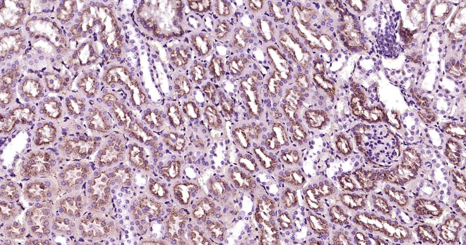 溶酶体相关膜蛋白2（CD107B）重组兔单抗