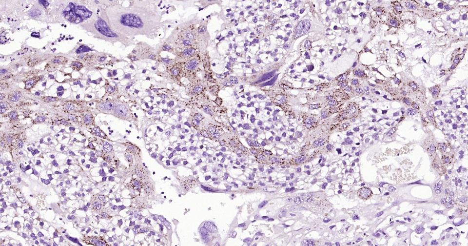 溶酶体相关膜蛋白2（CD107B）重组兔单抗