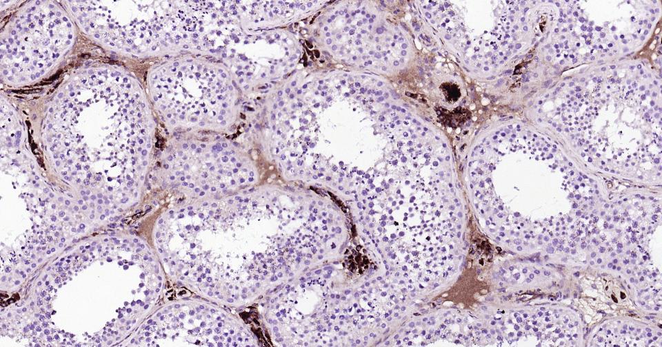 载脂蛋白E重组兔单抗