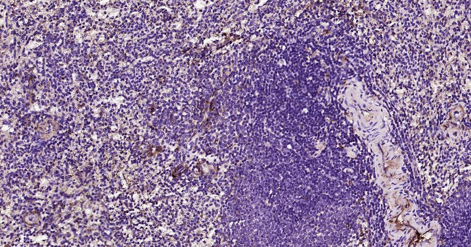 载脂蛋白E重组兔单抗