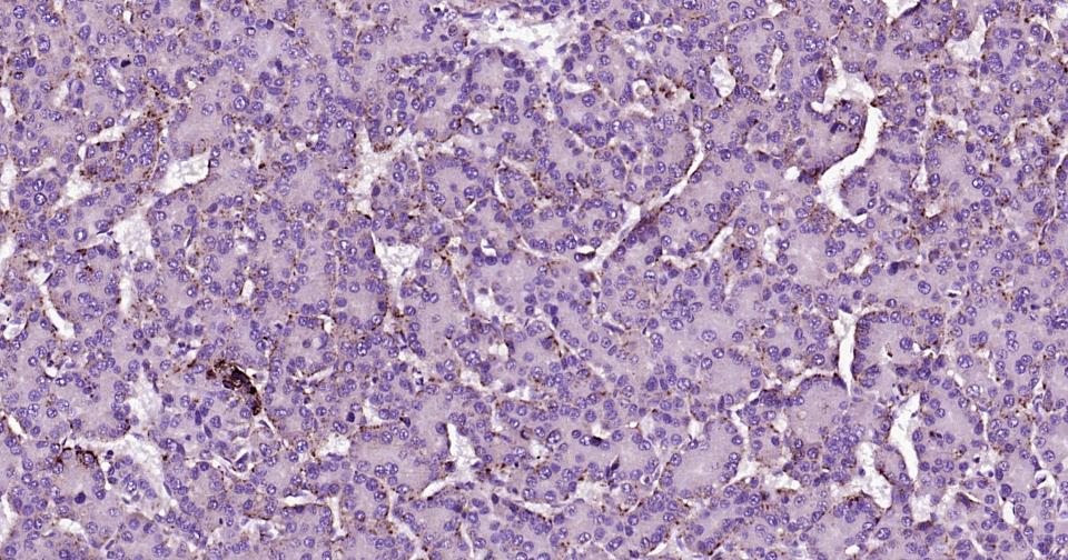 溶酶体相关膜蛋白2（CD107B）重组兔单抗