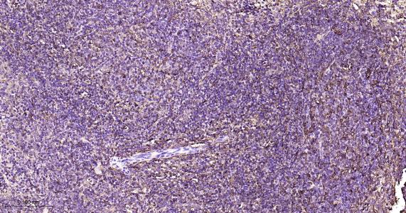 铁蛋白重组兔单抗