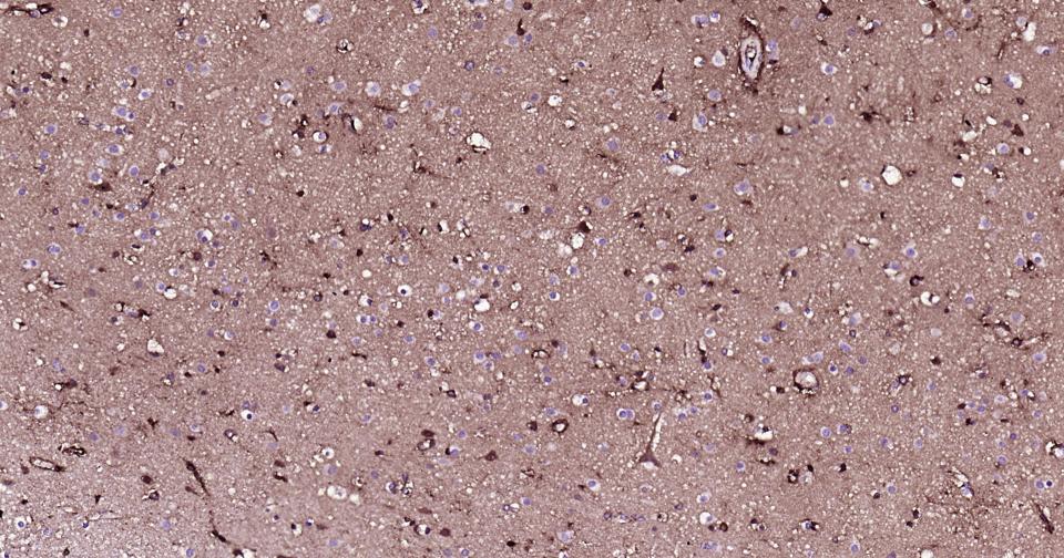 载脂蛋白E重组兔单抗