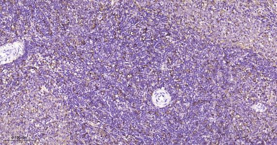 铁蛋白重组兔单抗