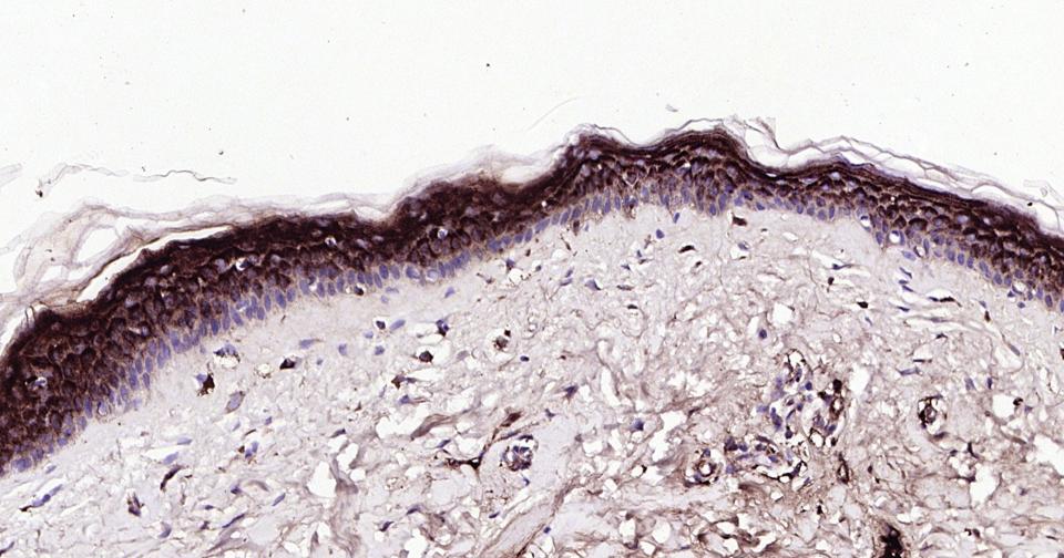载脂蛋白E重组兔单抗