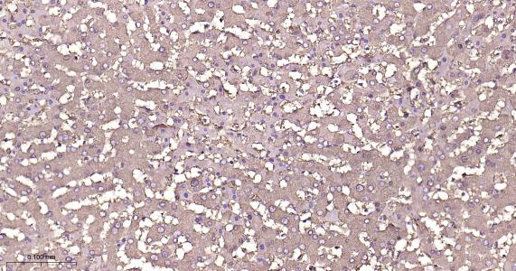 铁蛋白重组兔单抗