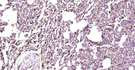 铁蛋白重组兔单抗