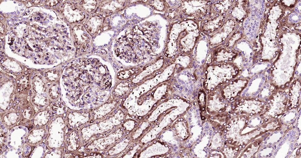 载脂蛋白E重组兔单抗