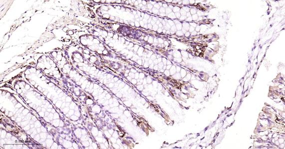 铁蛋白重组兔单抗
