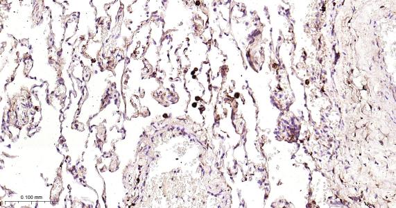 铁蛋白重组兔单抗