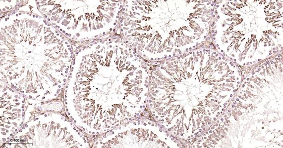 铁蛋白重组兔单抗