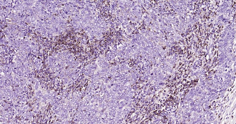 溶酶体相关膜蛋白2（CD107B）重组兔单抗