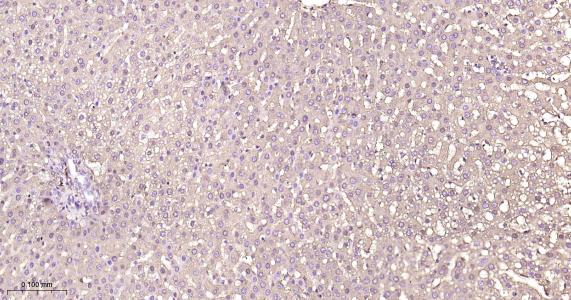 铁蛋白重组兔单抗