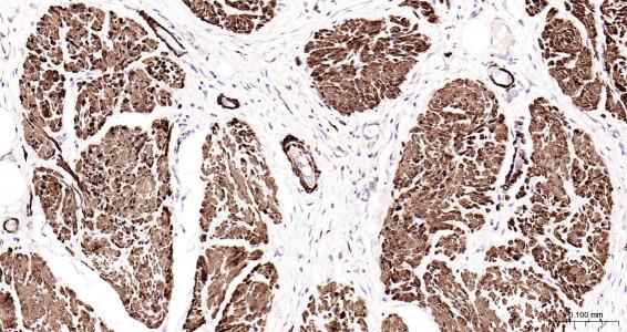 结蛋白抗体-bs-1026R