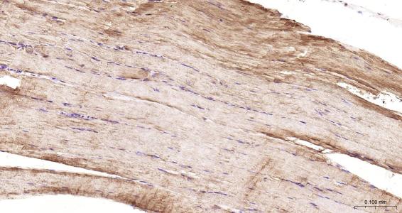 结蛋白抗体-bs-1026R