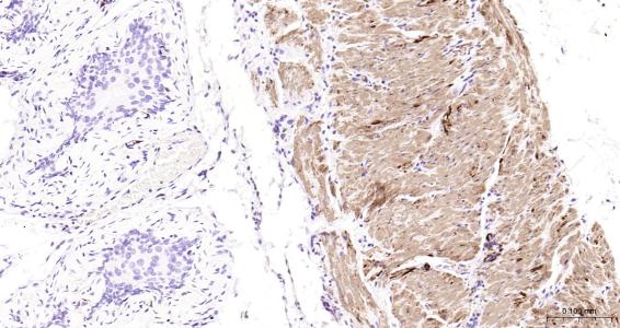 结蛋白抗体-bs-1026R