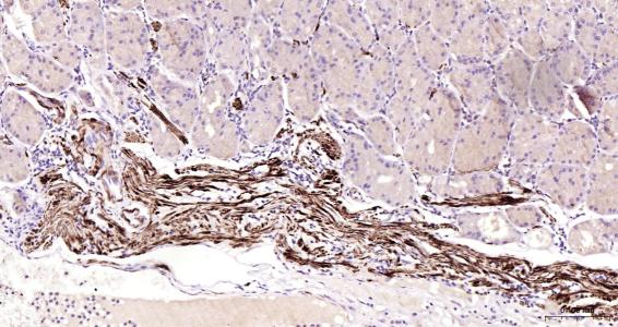 结蛋白抗体-bs-1026R