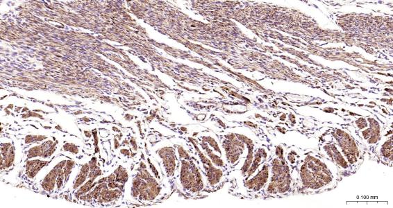 结蛋白抗体-bs-1026R